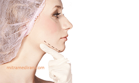 lower face plastic surgery