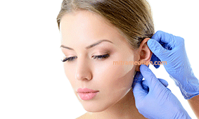 ear plastic surgery