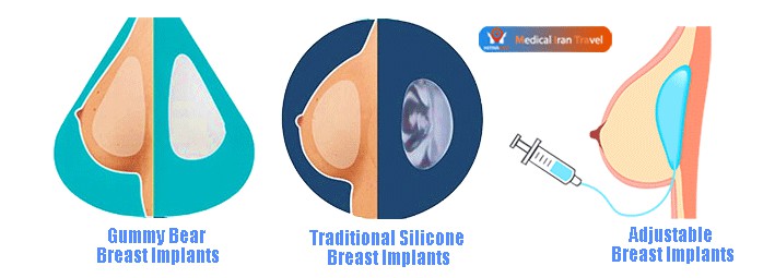 Various Size, Shape, and Material of Breast Implants