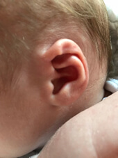 Lidding Ear