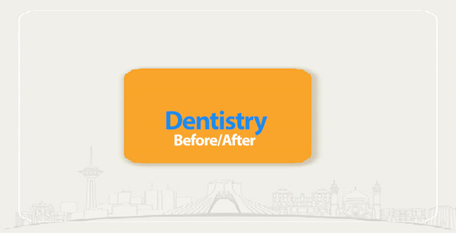 dentistry before after